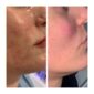 before-after-7